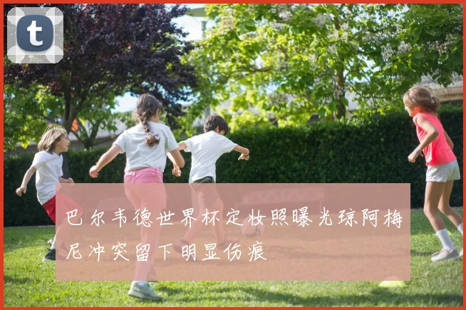 巴尔韦德世界杯定妆照曝光琼阿梅尼冲突留下明显伤痕